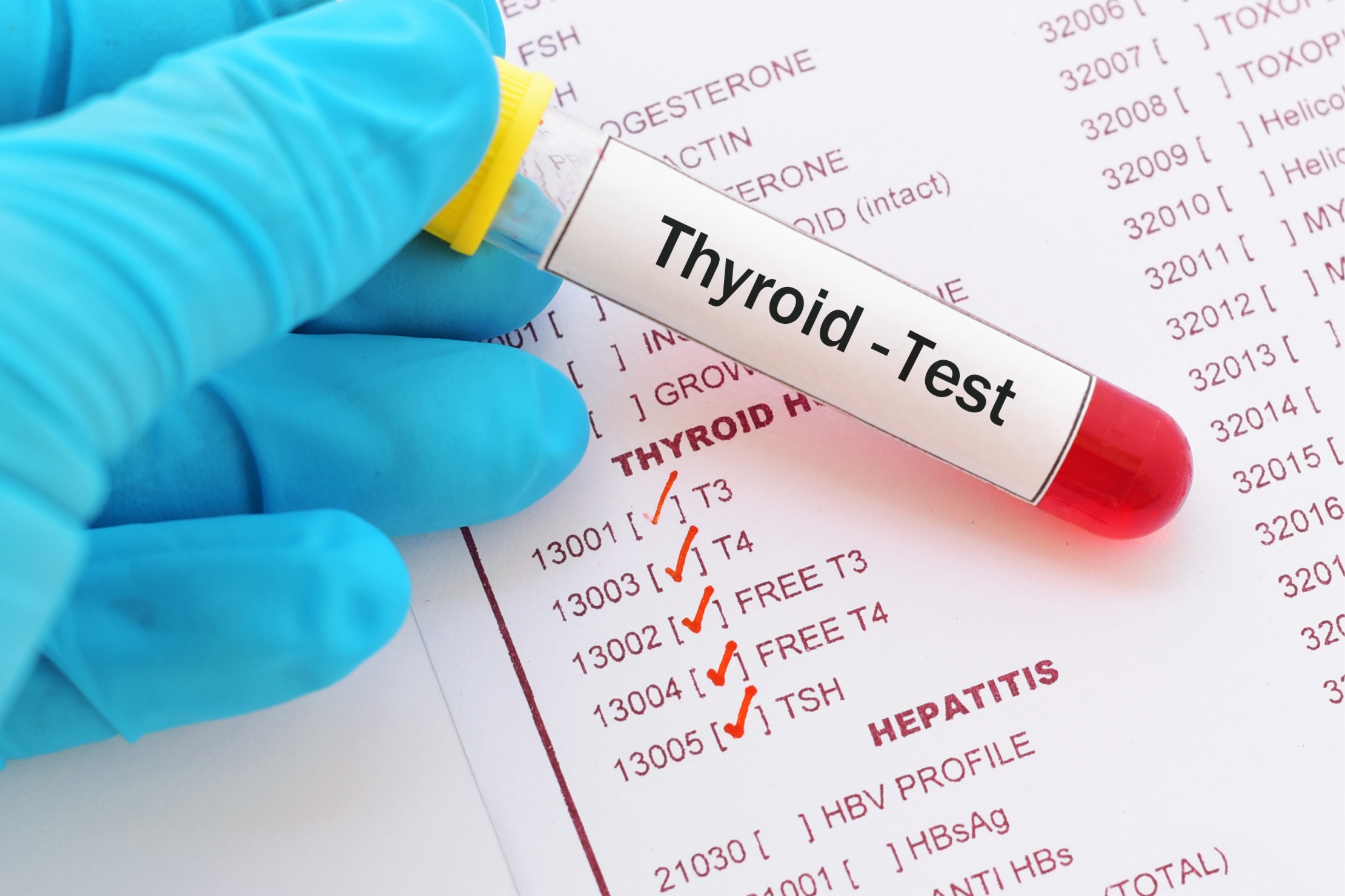 All About Thyroid Tests at Home – derneuemannde