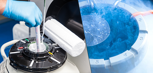 Cryopreservation for In-Vitro Fertilization